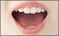 歯周病・口臭治療